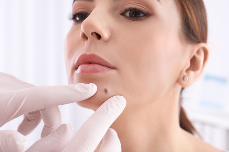 Ambulatório de Tumores da Pele da Face